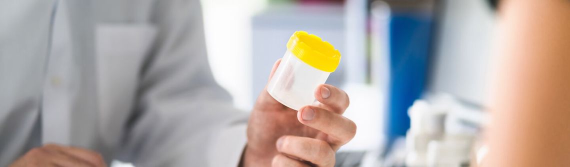 Person handling a urianalysis sample bottle.